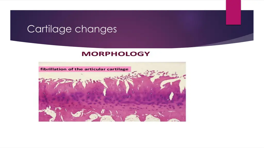 cartilage changes