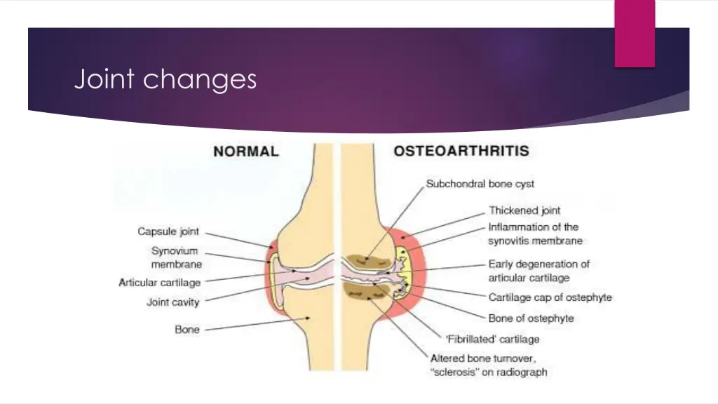 joint changes 1