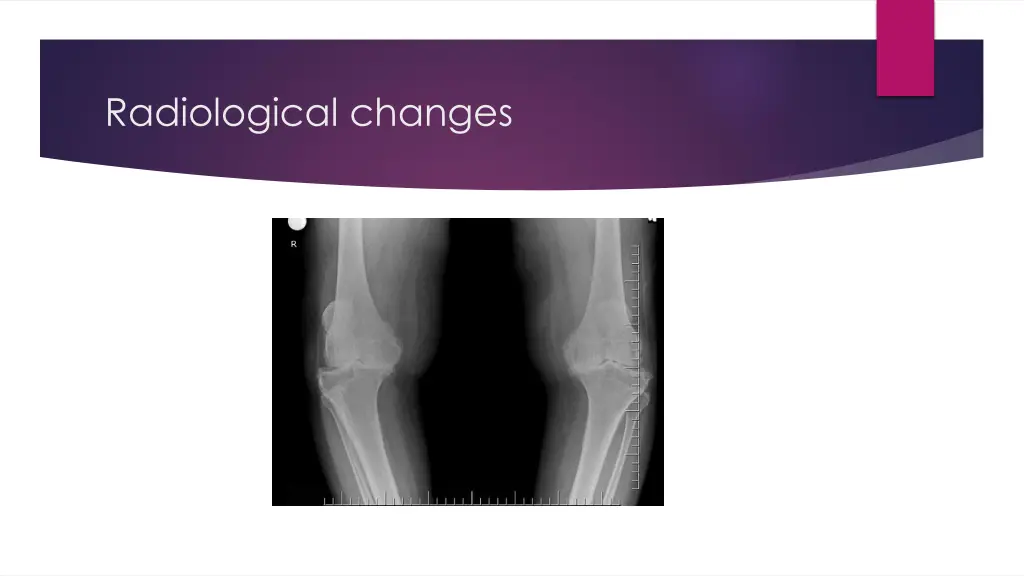 radiological changes