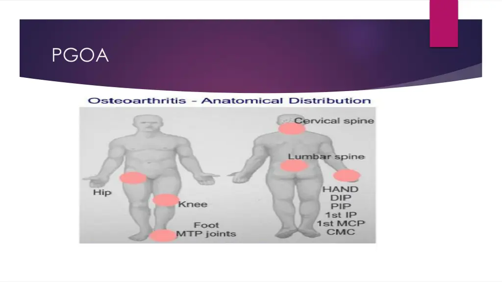 slide21
