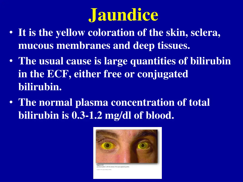 jaundice