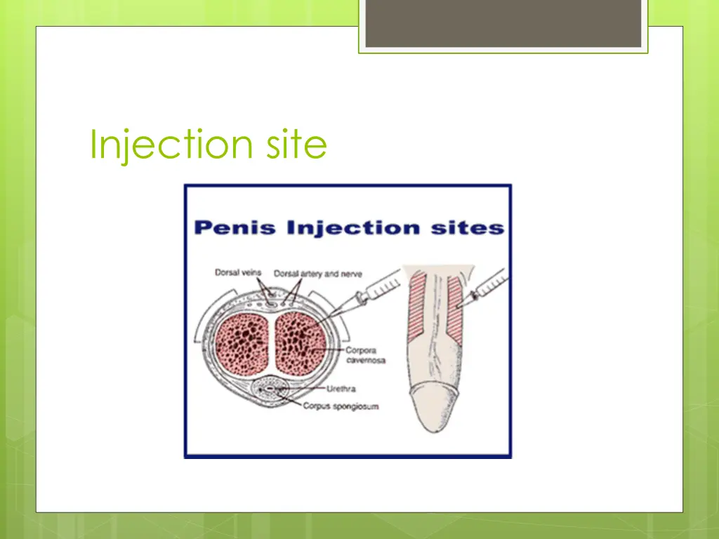 injection site