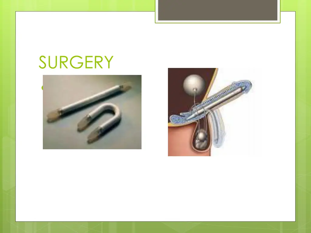 surgery