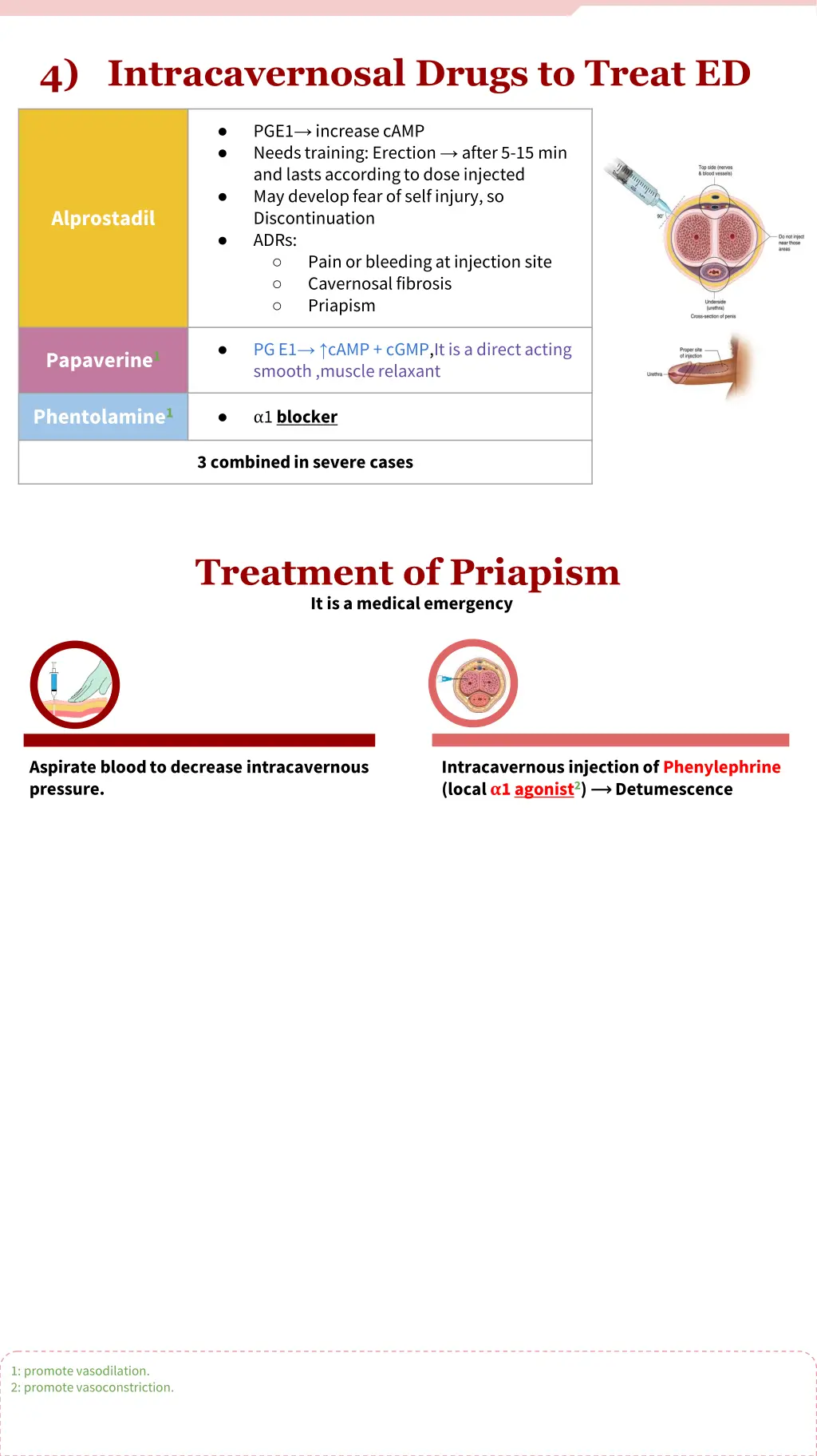 4 intracavernosal drugs to treat ed