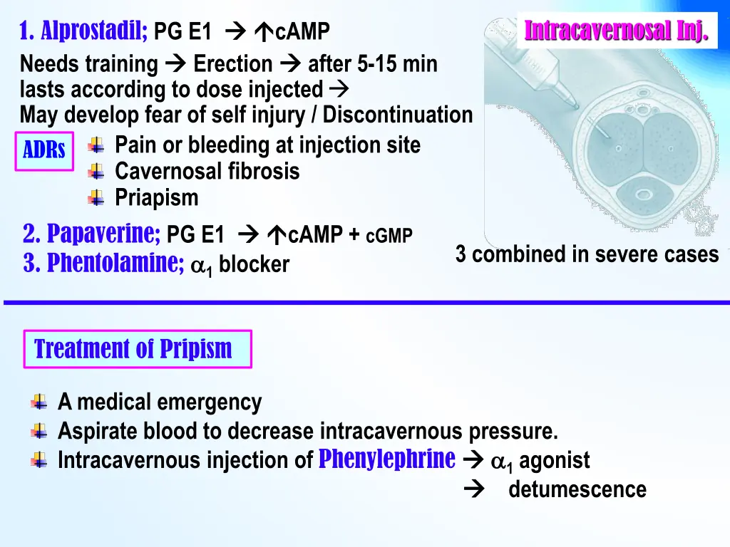 intracavernosal inj