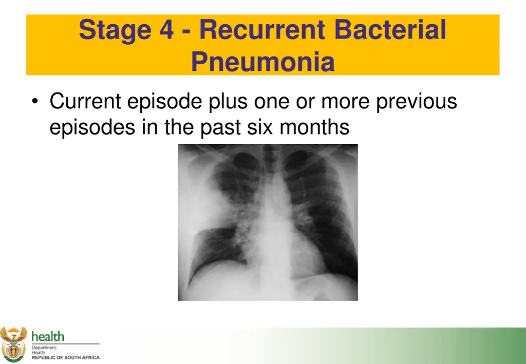stage 4 recurrent bacterial pneumonia current