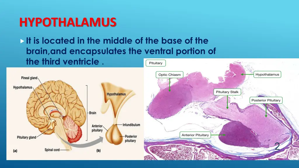 hypothalamus