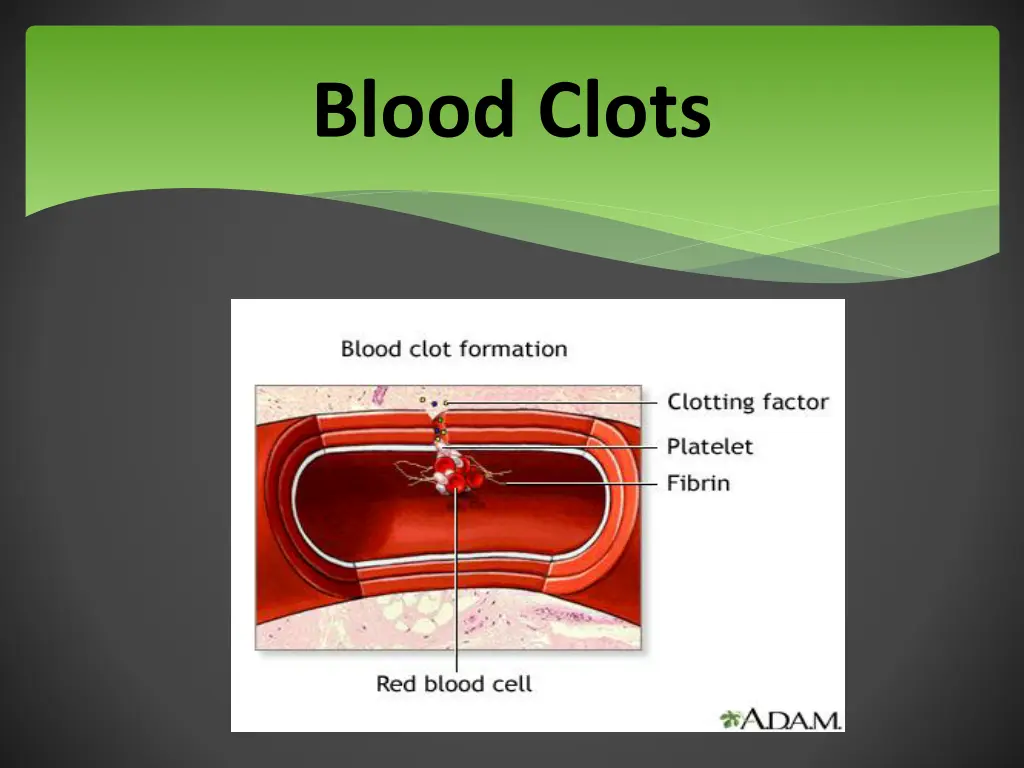 blood clots