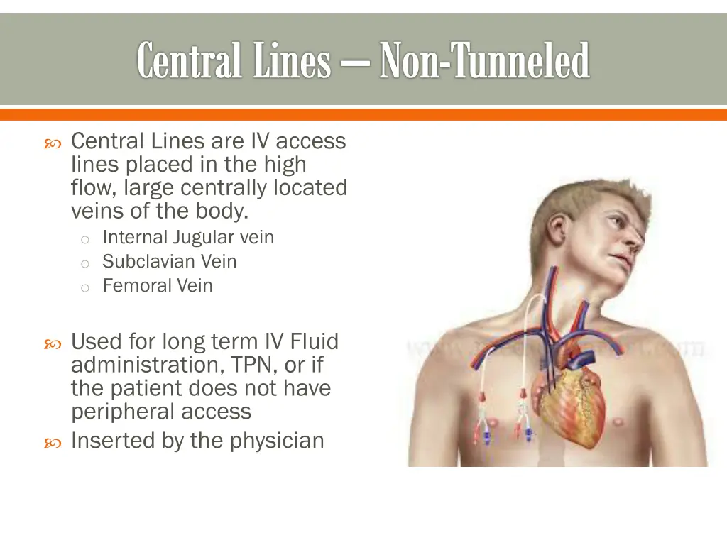 central lines non tunneled