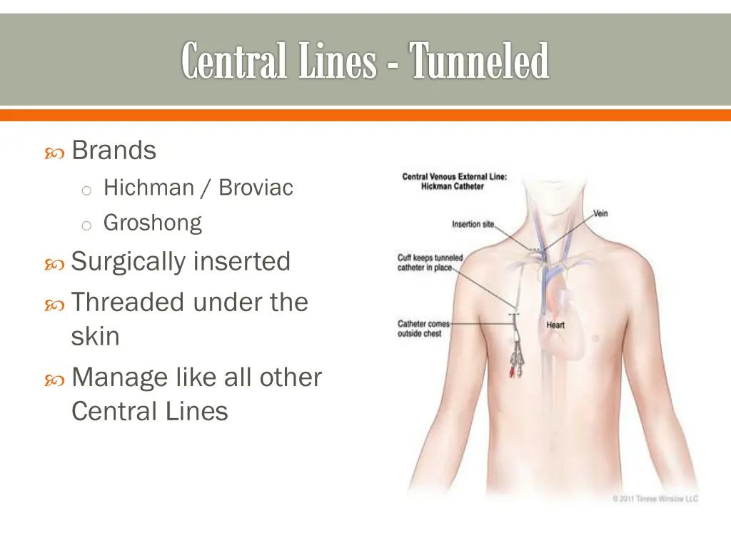 central lines tunneled