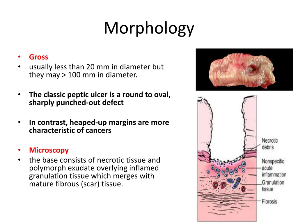morphology