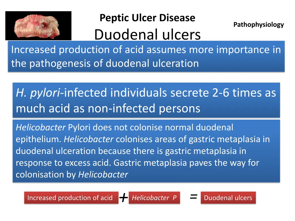 peptic ulcer disease duodenal ulcers