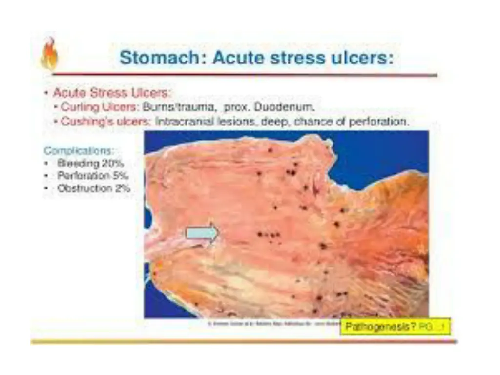 slide14