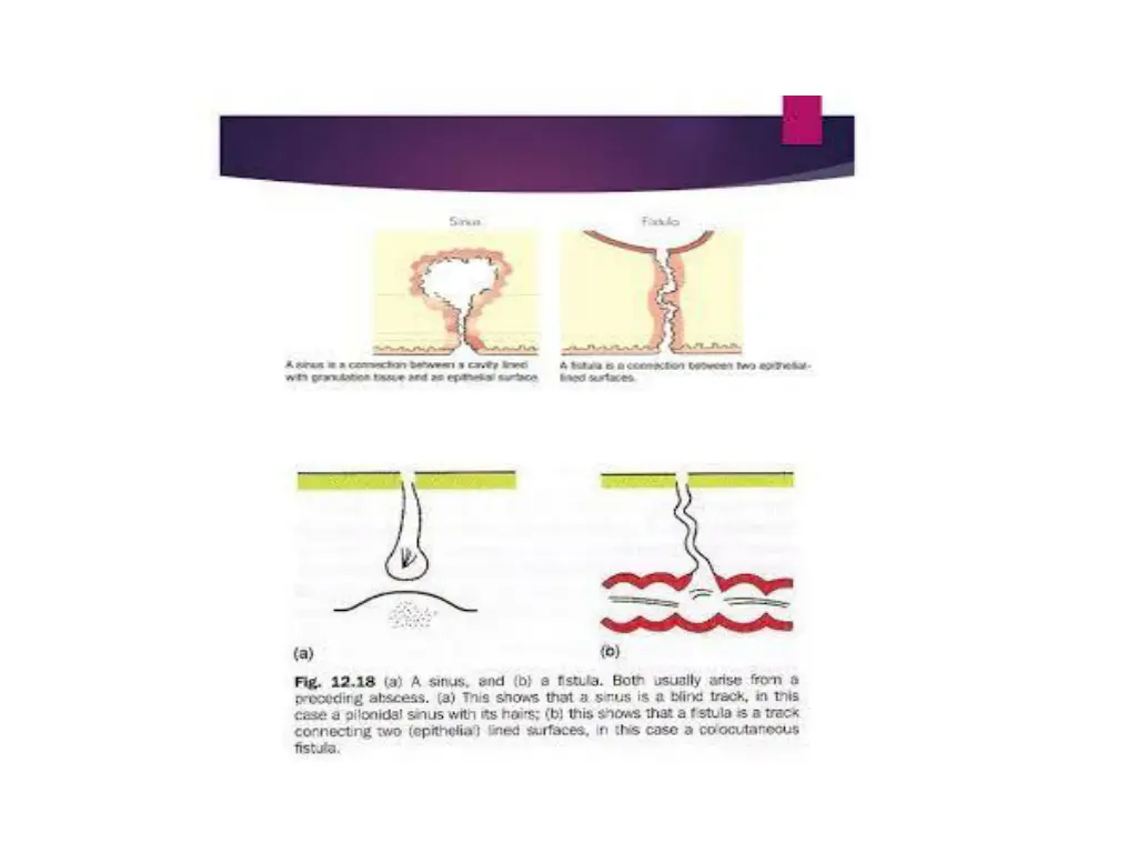 slide3