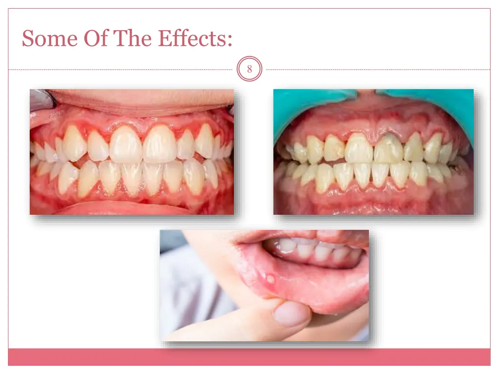 some of the effects