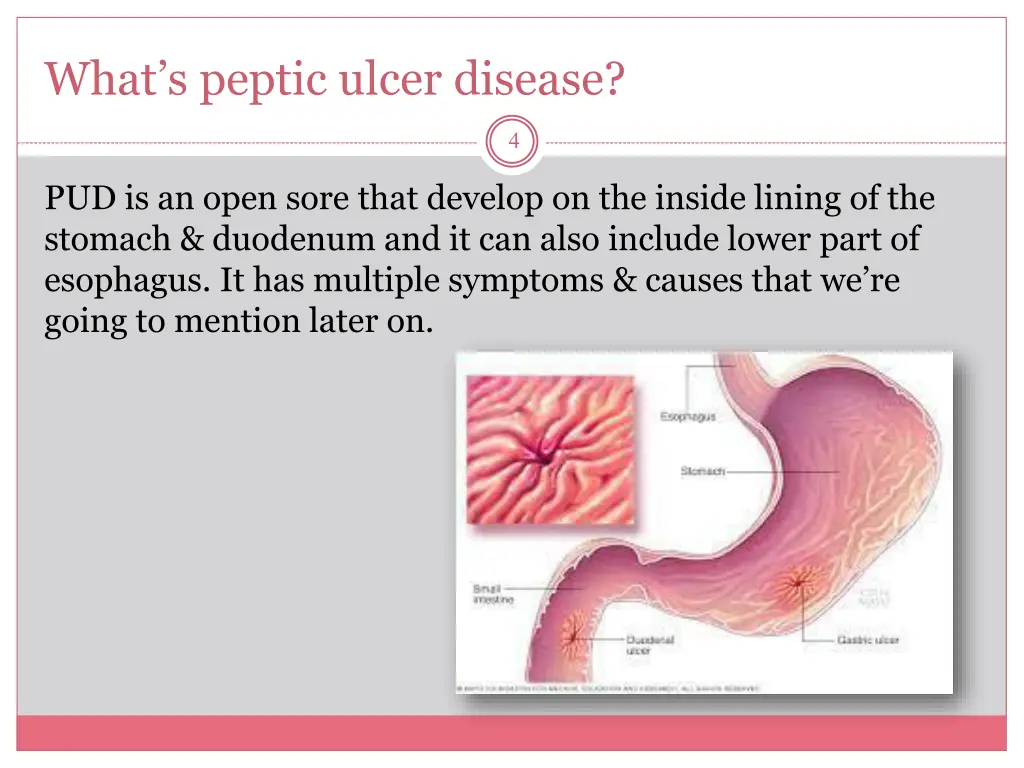 what s peptic ulcer disease