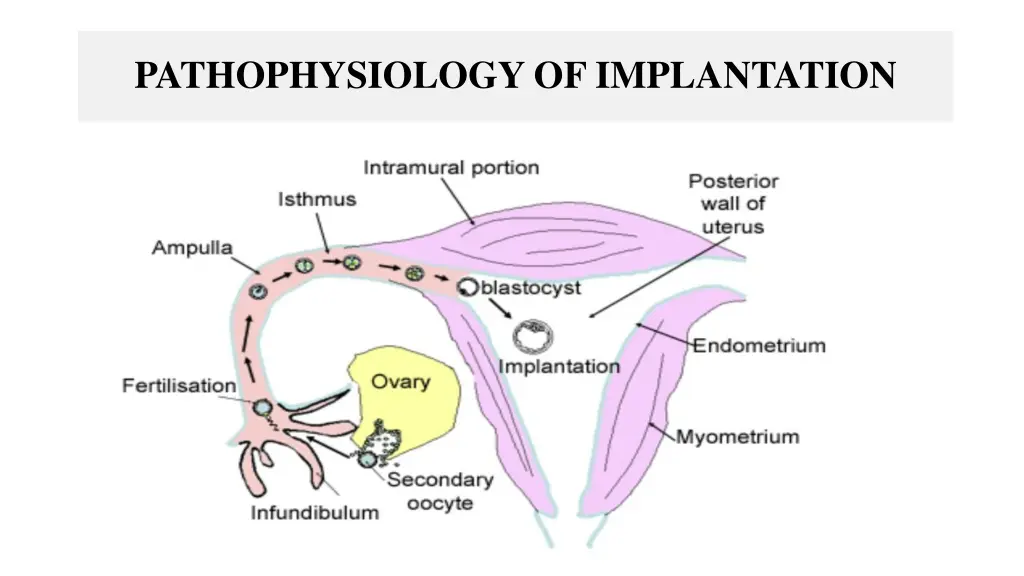 pathophysiology of implantation