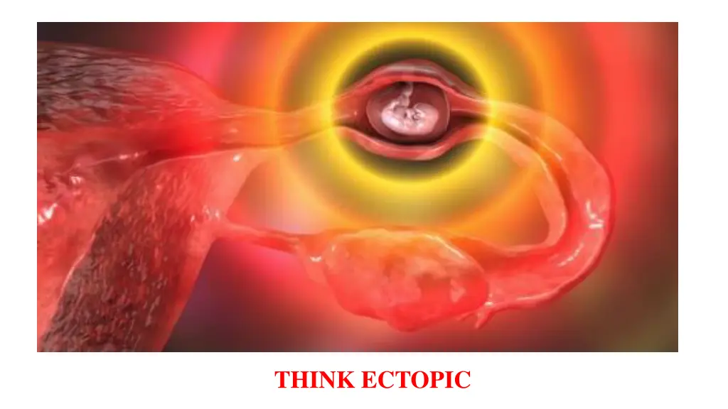 think ectopic
