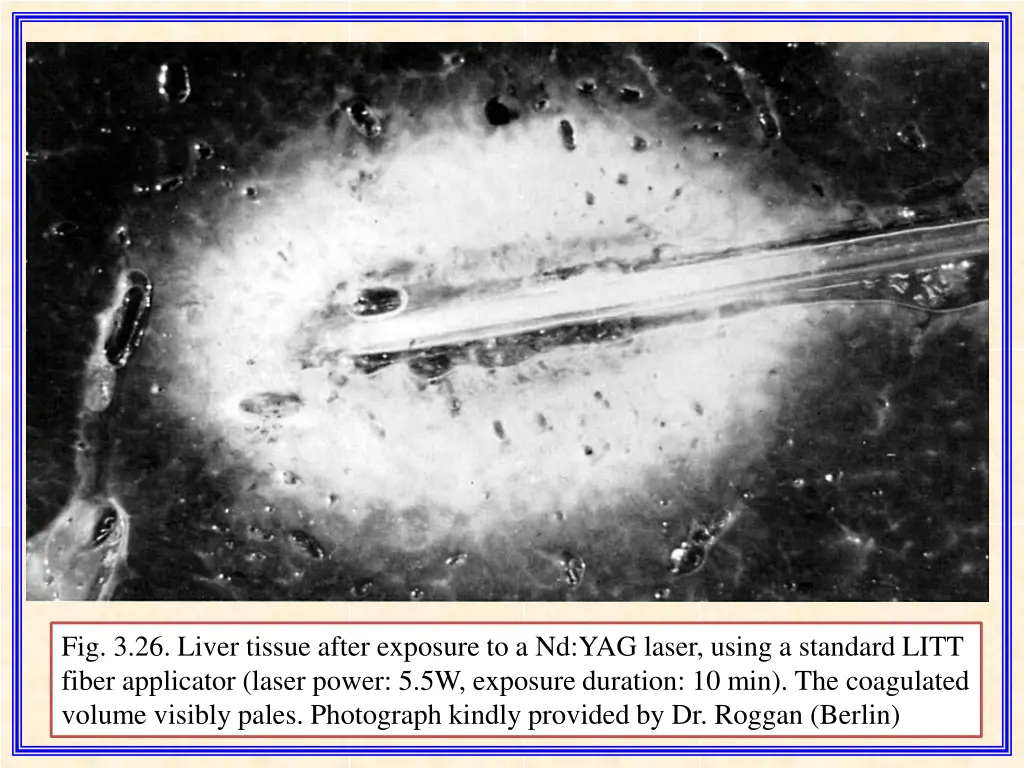 fig 3 26 liver tissue after exposure