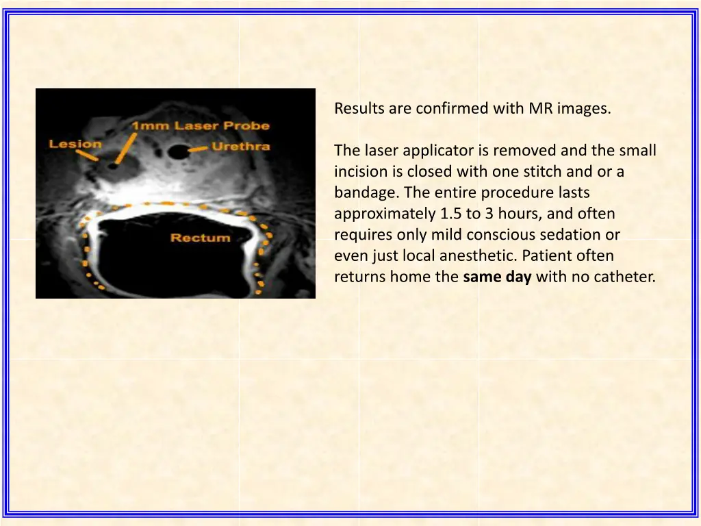 results are confirmed with mr images