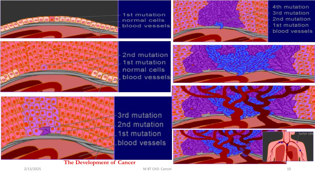 the development of cancer