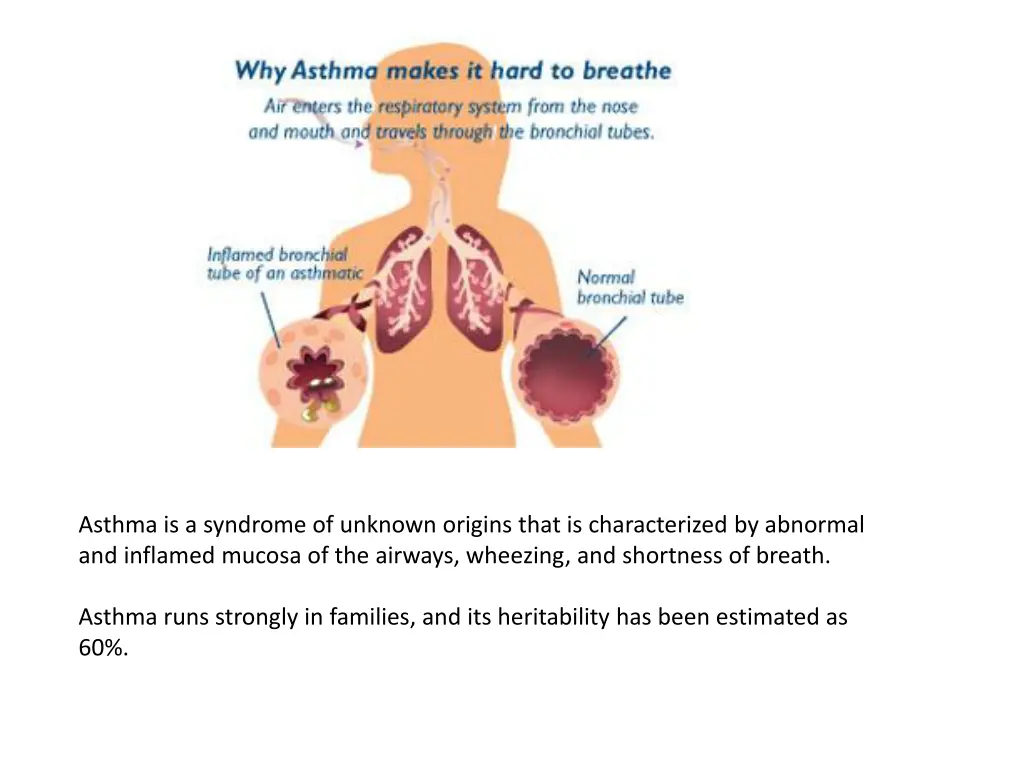 asthma is a syndrome of unknown origins that