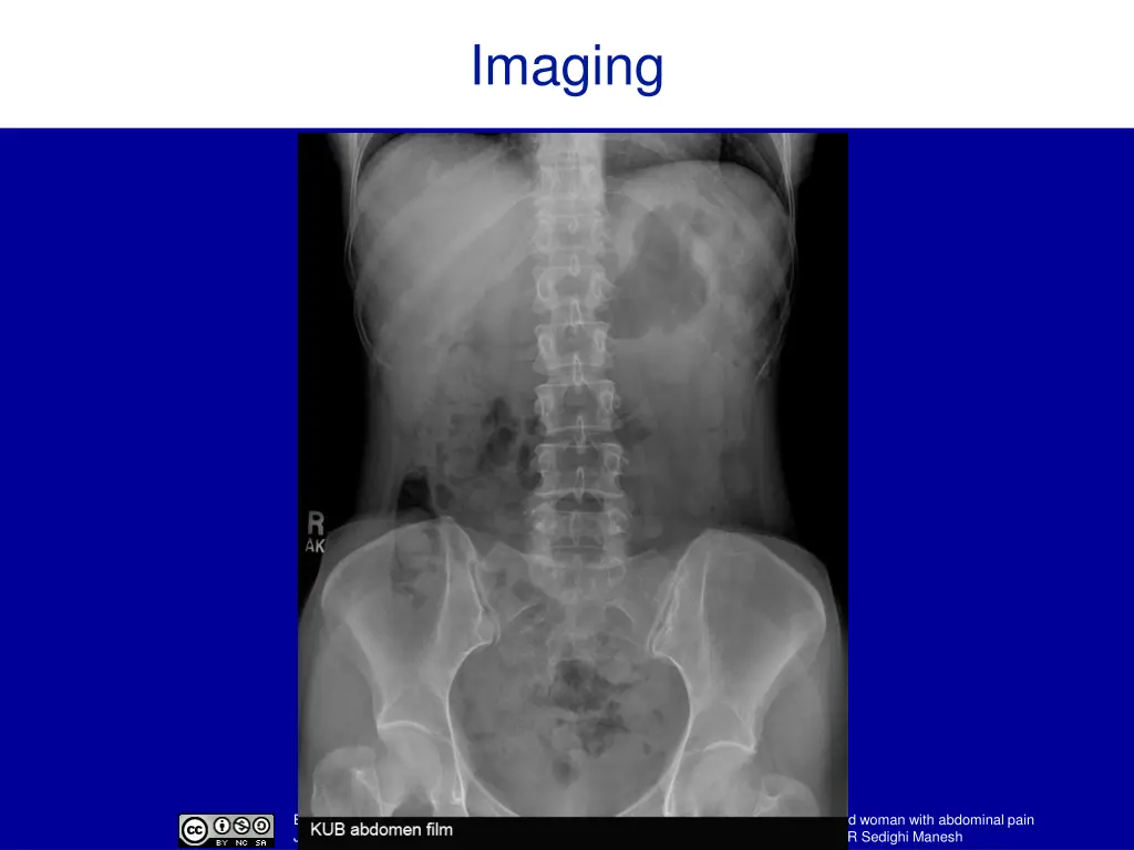 imaging
