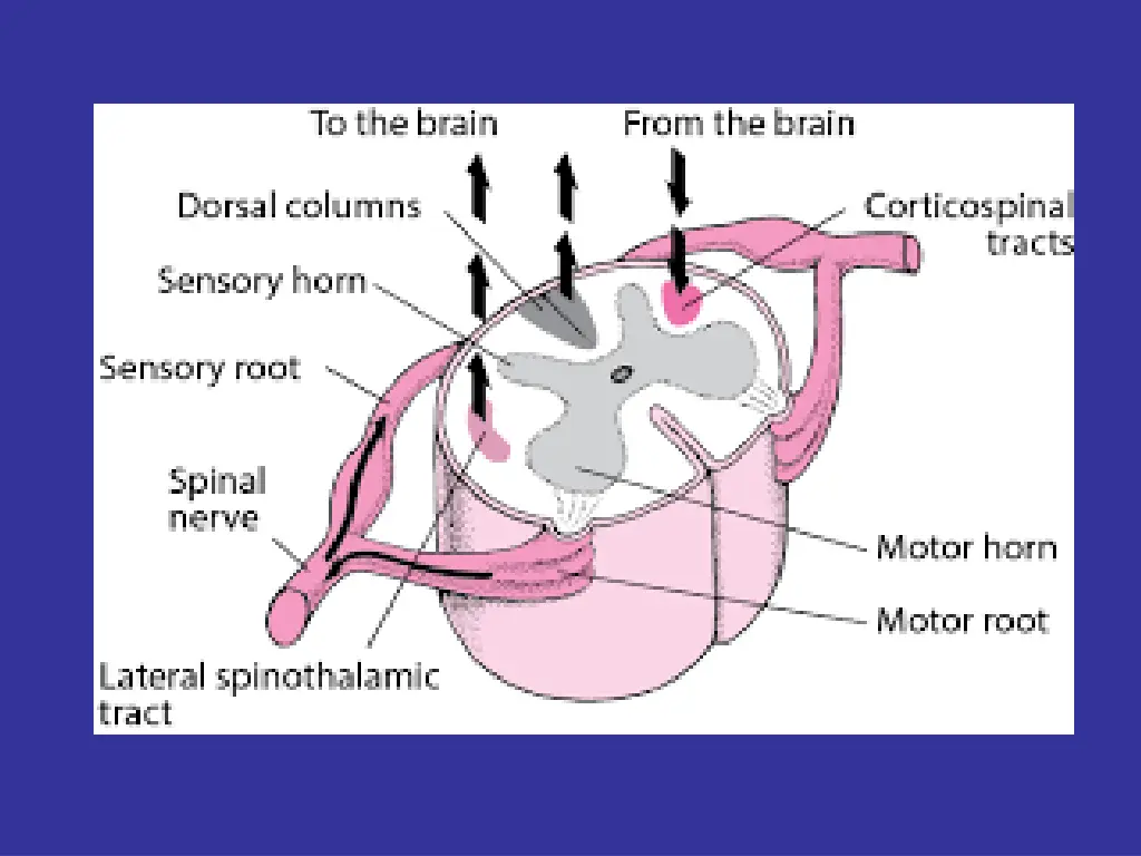 slide13