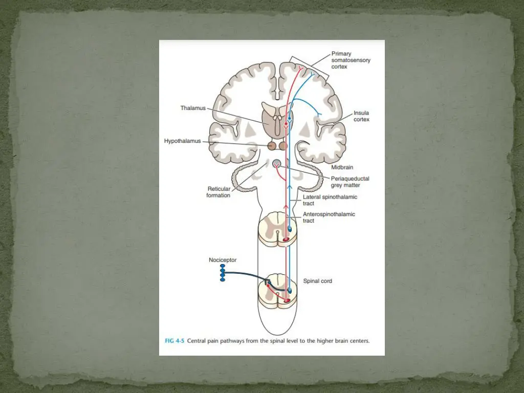 slide5