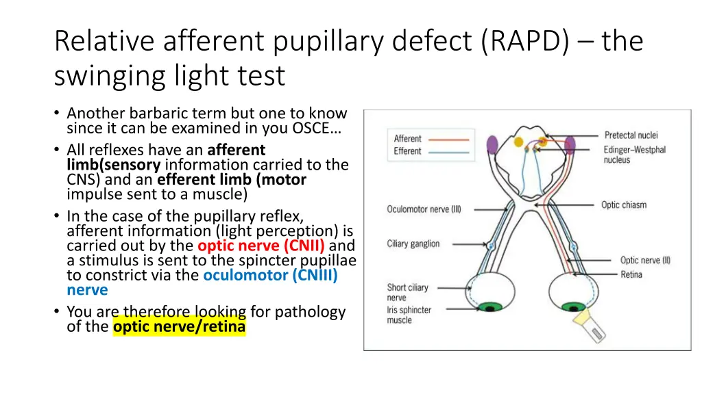 relative afferent pupillary defect rapd
