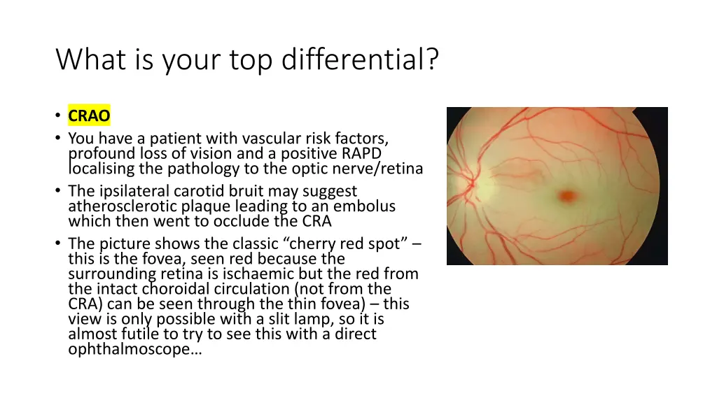 what is your top differential
