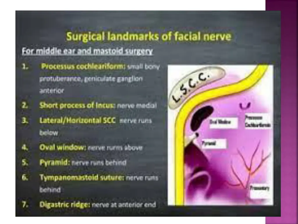 slide22