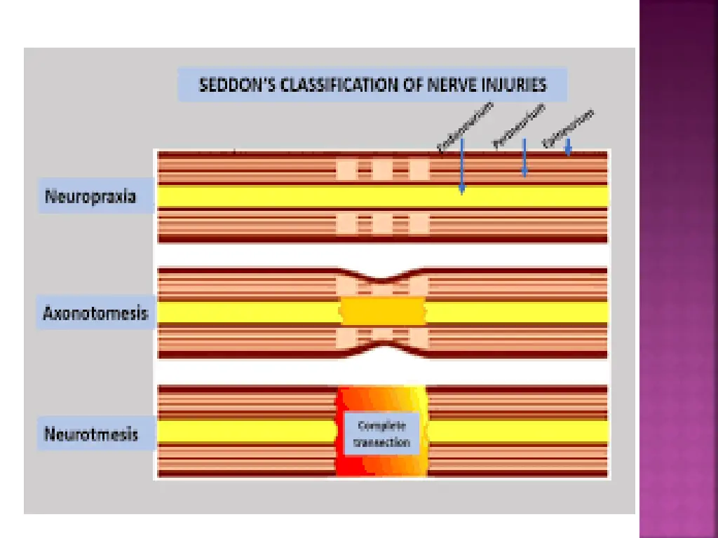 slide27