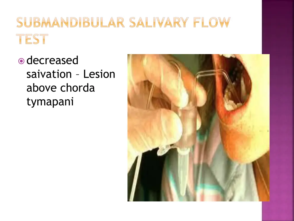 submandibular salivary flow test