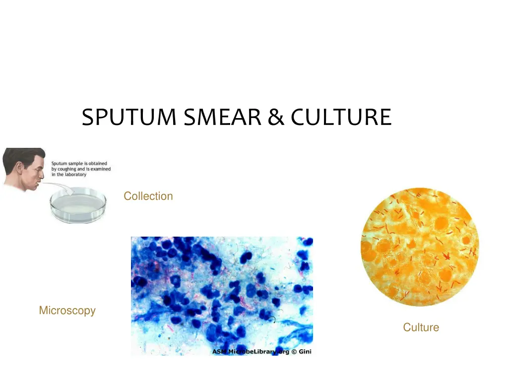 sputum smear culture