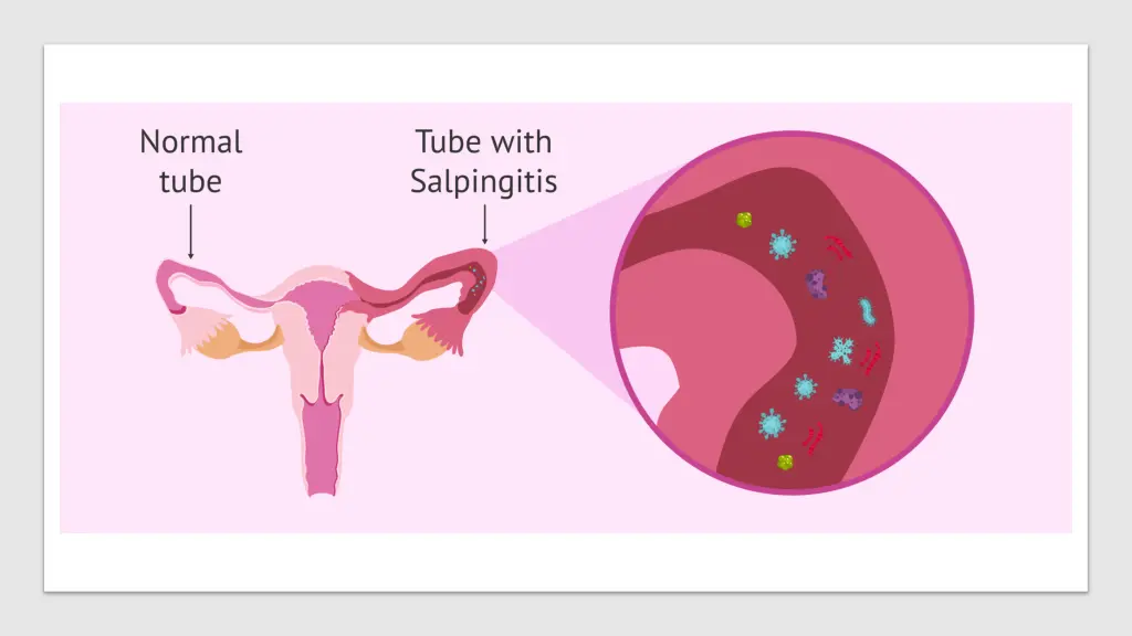 slide11
