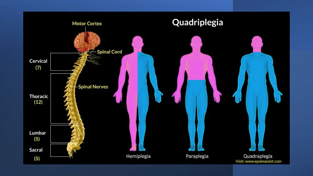slide26