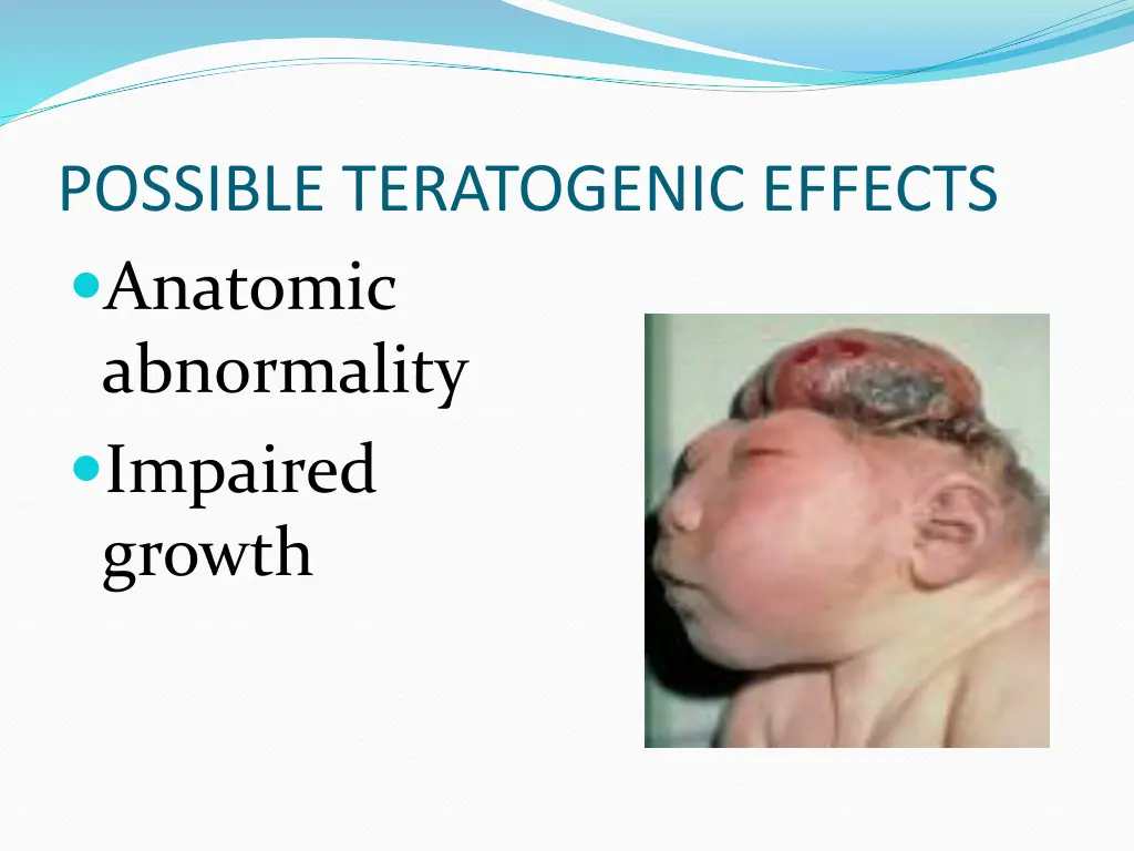 possible teratogenic effects anatomic abnormality