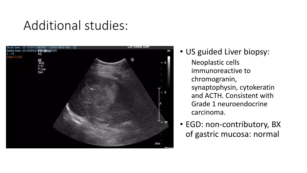 additional studies