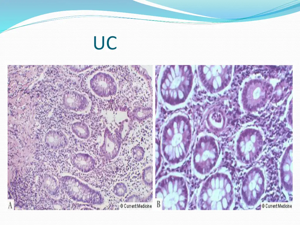 slide17