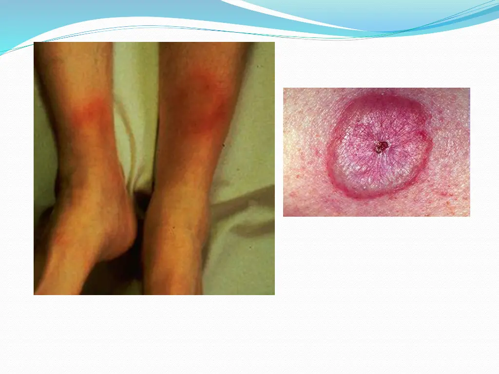 slide30