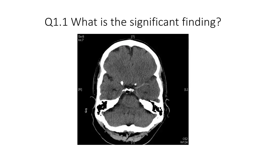 q1 1 what is the significant finding