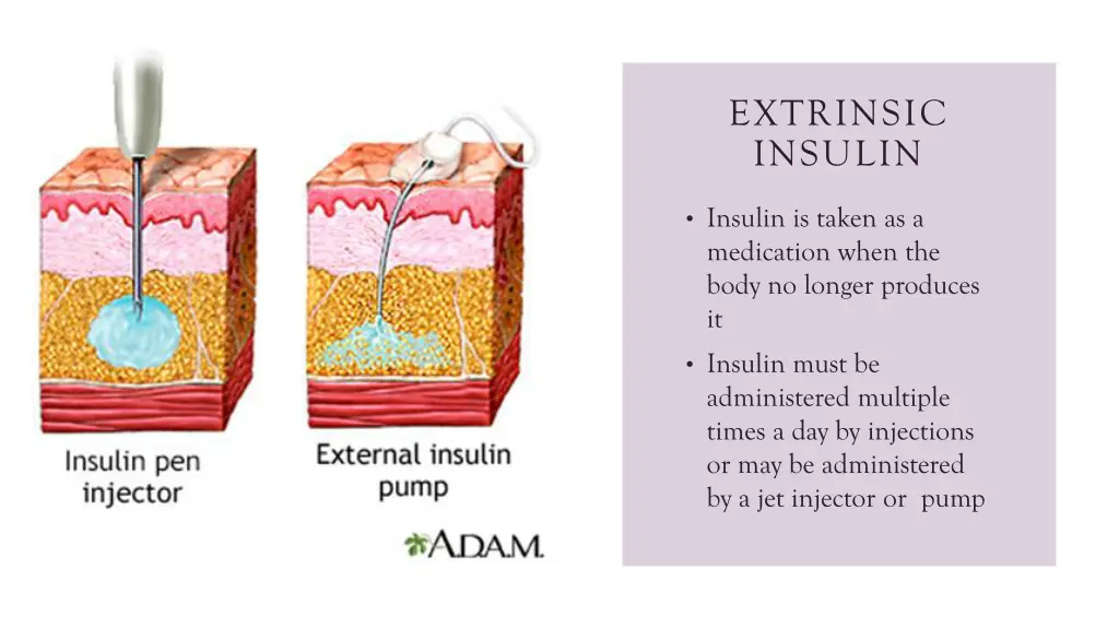 extrinsic insulin