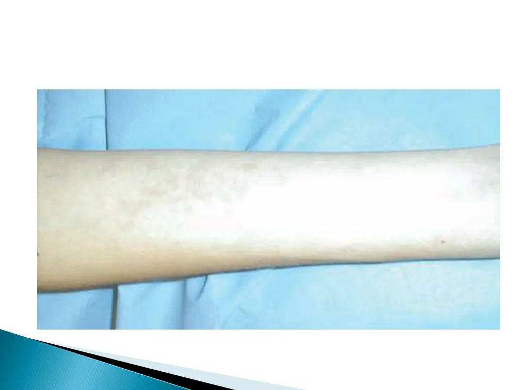 slide11