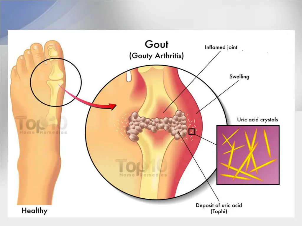 slide8