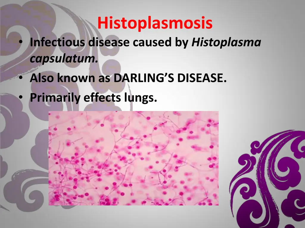 histoplasmosis