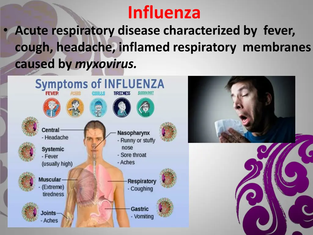 influenza