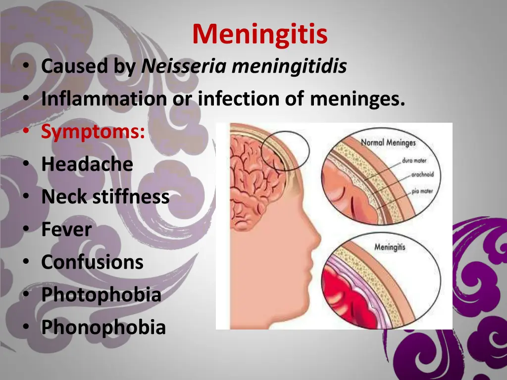 meningitis