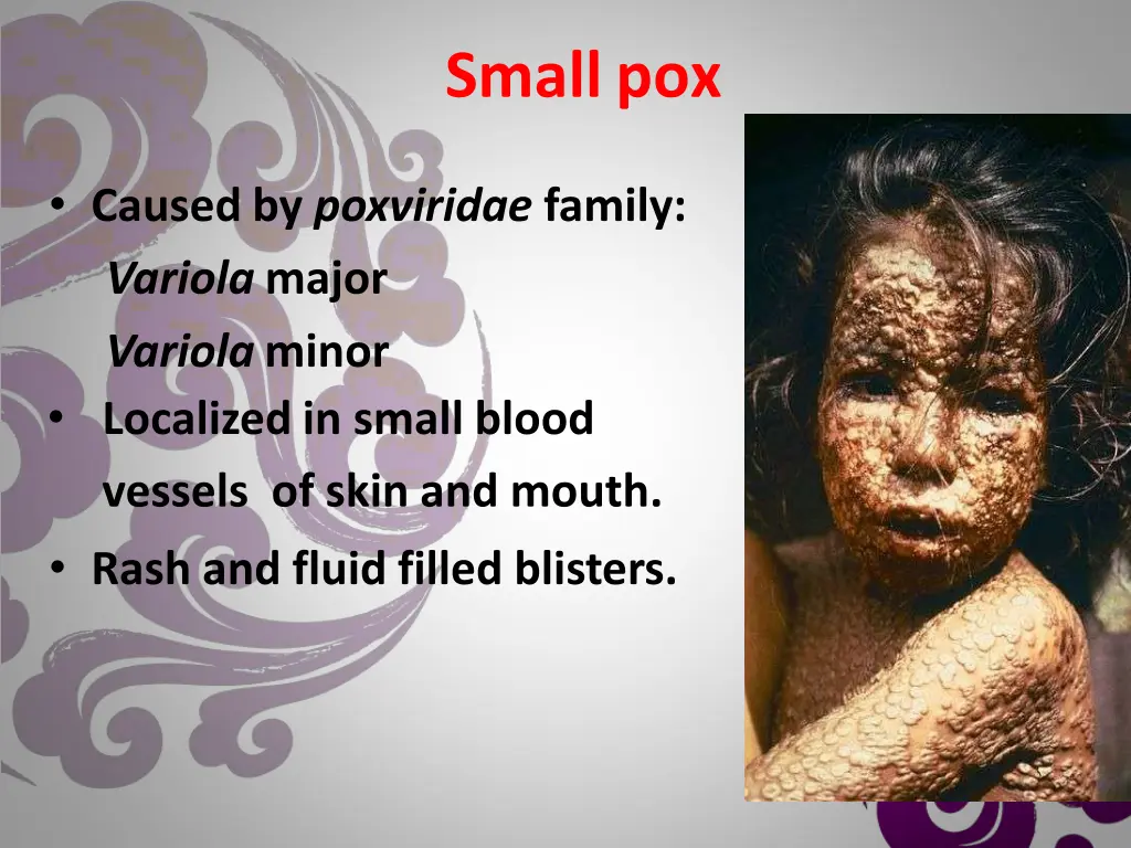smallpox