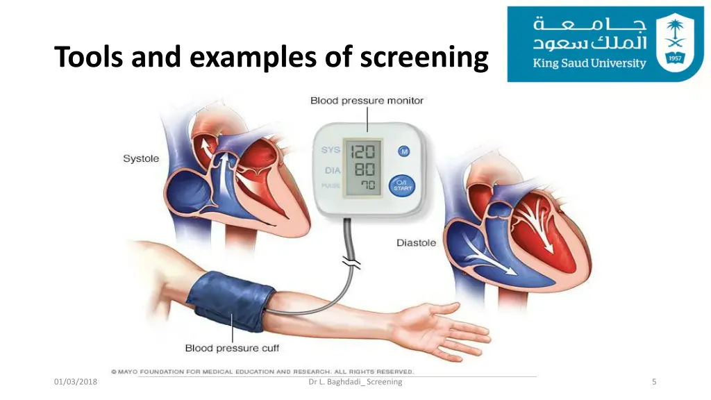 tools and examples of screening